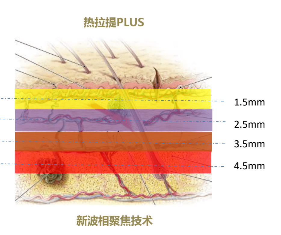 网友|高圆圆复出有点坎坷，产后1年首次亮相网友们为这生图吵翻天！
