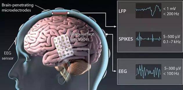 接口|阿里巴巴布局脑机接口，还要研究虚拟女友？
