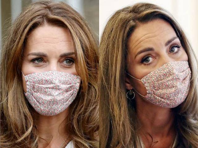 女明星|女明星“眼下增肥”是什么操作？