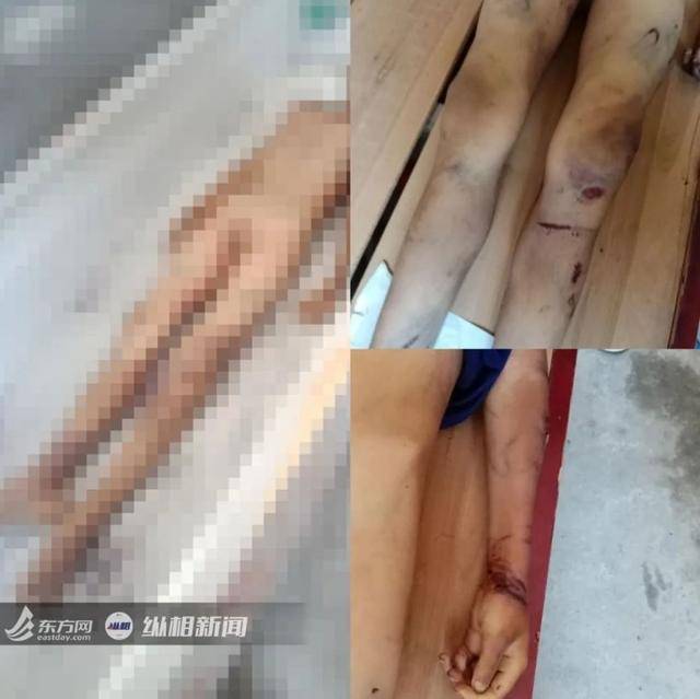 怎么捆新生儿 731d3bd7731f4c4e98b58a11e273188d.jpeg