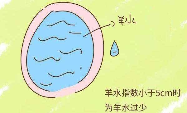只有怀孕才有羊水吗 3b080e433c2947d6bcba4c9acddbf8a8.jpeg