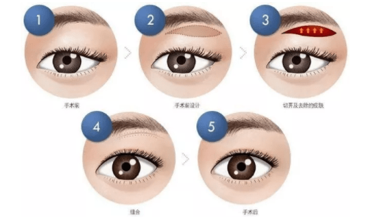 b5031b49e3894c5fb91e12c70fb46e4f.png
