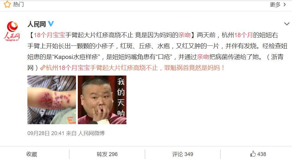又见“亲吻病”，这5类人别亲孩子