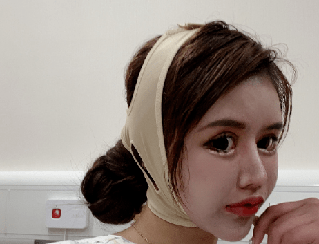 过往|整容200多次的网红曝辛酸过往：在幼儿园就受歧视，还被叫黑婆