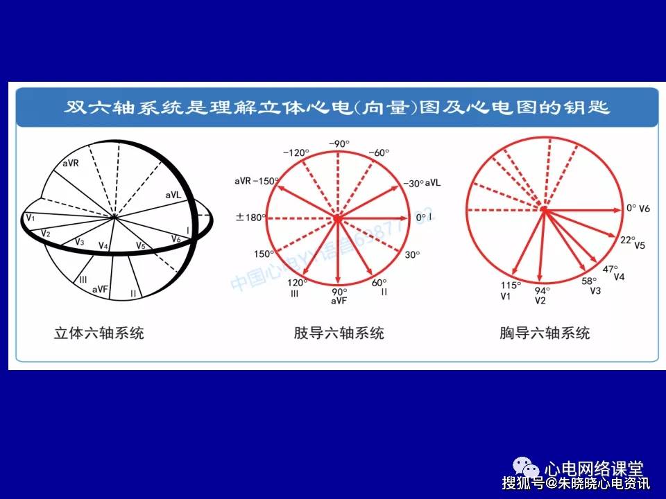 心电轴偏移在心电图和向量图上的对比分析