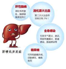 患上肝硬化如何护理呢有什么治疗方法呢