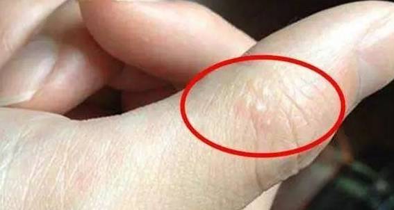 是什么原因引起的湿气重 d79b127c2e3c4ee4821965d50e5645da.jpeg