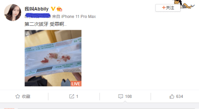 连拔|史上最拼的网红？艾比为整容连拔2次牙，脸都肿了一圈