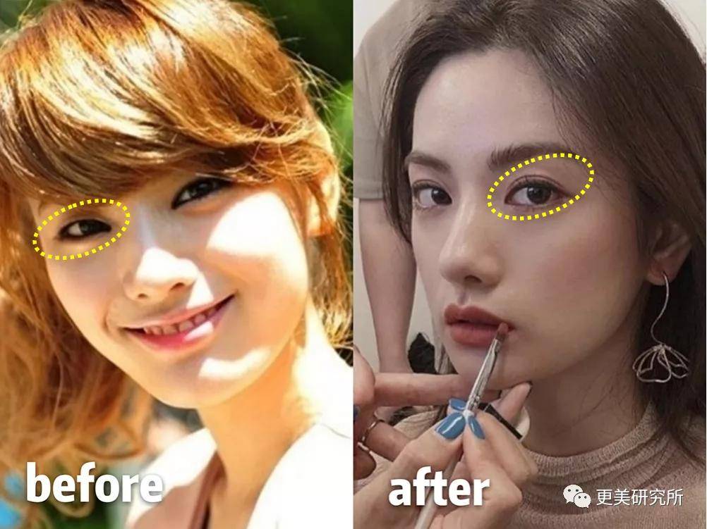 do|20年不崩的do圈C位,鞠婧祎baby都求她医生,堪称医学奇迹