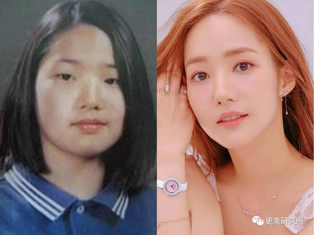 do|20年不崩的do圈C位,鞠婧祎baby都求她医生,堪称医学奇迹