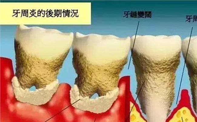 供养|没了红气供养的范冰冰眼里星光黯淡，复出之路还接遭网红拉踩？