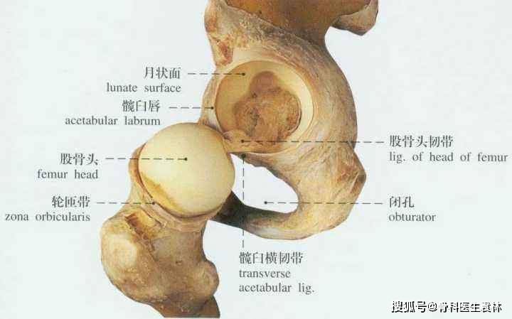 股骨头坏死又称股骨头缺血性坏死,系指股骨头血供