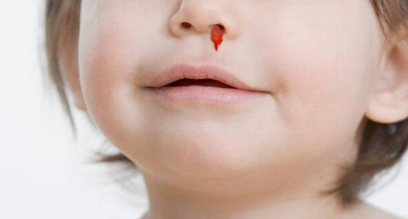 为什么小孩会经常流鼻血