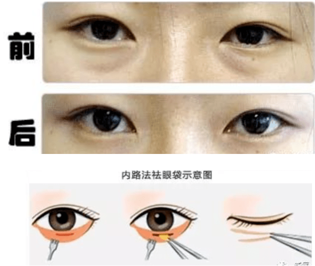 眼睛|2020年度爆红第一女星，脸上最成功的地方居然是双眼皮？