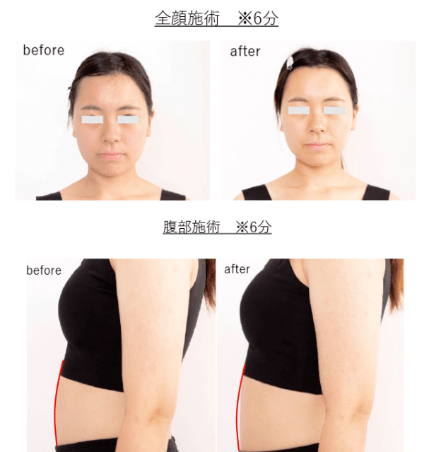 一手|杨幂一手流量一手奶狗？少女感才不是她的绝杀，模仿大花的手段才是真....