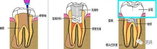 男友|浪荡一生，出道26年换14任男友，她比萧亚轩还野