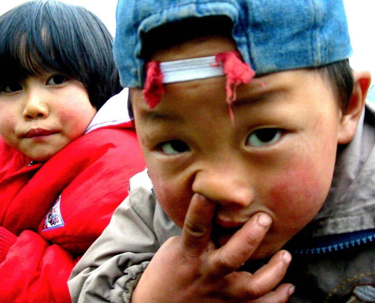 牙齿|只会越长越丑，你家孩子有中招吗？这5种孩子小时候好看也没用