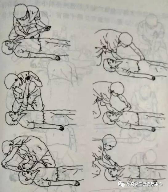 2,肘部训练