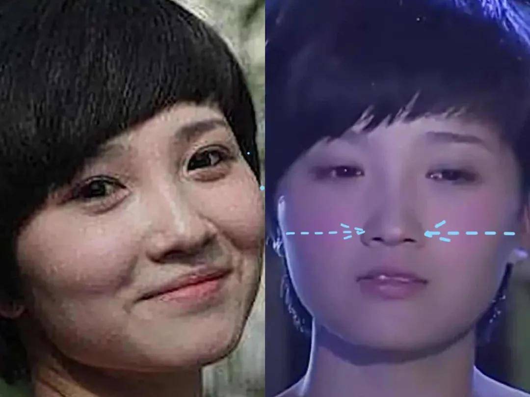 8分|3分到8分，为什么有人是天生适合整容脸?