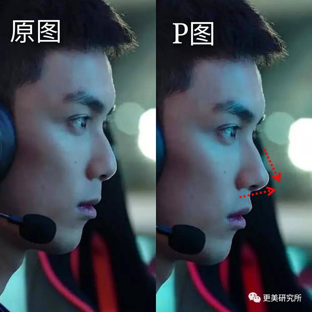 鼻尖|杨幂终于去修复鼻子了…
