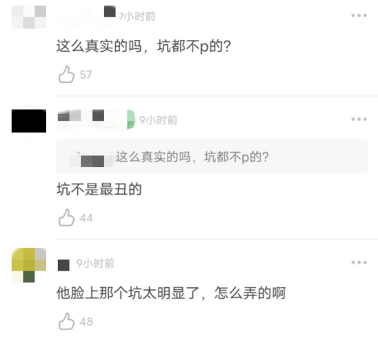 抬头纹|易烊千玺代言图被嘲，抬头纹明显太苍老，嘴型不好看还凸出