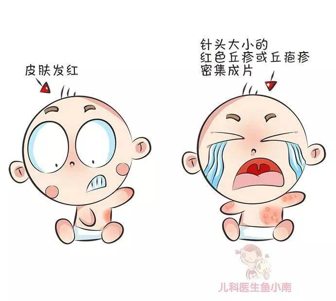 皮肤|医生：首先你必须要分清皮疹湿疹热疹这3种宝宝皮肤问题总反复