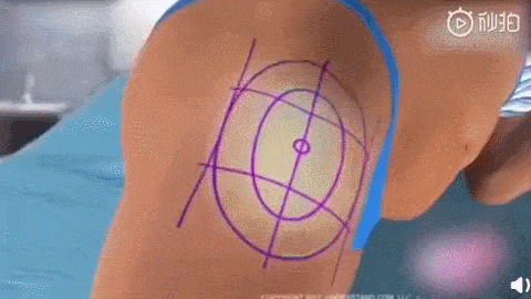 脂肪|鞠婧祎再花70w能do成迪丽热巴的前凸后翘？！