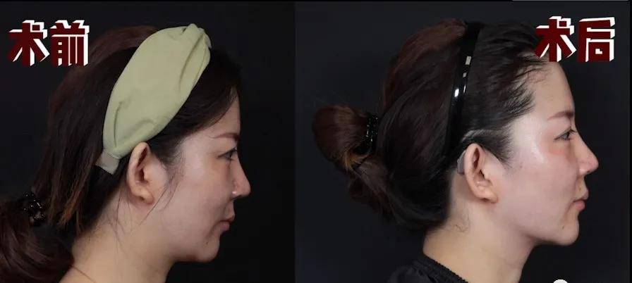鞠婧祎|央视镜头的照妖镜下，鞠婧祎彻底翻车，被嘲土丑的她却逆天翻盘?