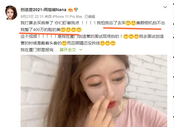 细节|13岁开始整容的周楚娜公开相关细节：花费四百万，打上百针麻药