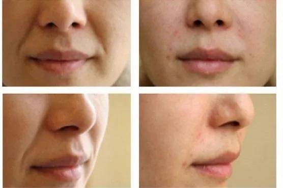 fa|央视镜头太可怕了,张天爱鼻子顶破天,被李沁吊打…