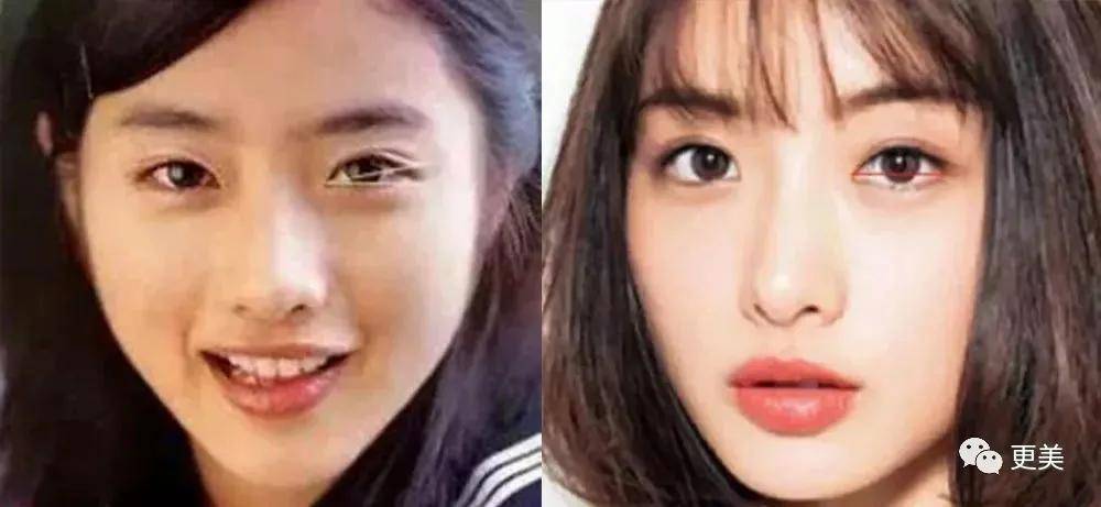 do|胖成球，眼睛do到快掉出眼眶，周杰伦最美“前女友”咋了...