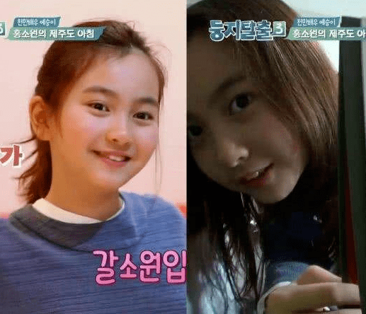 肤色|曾经全网为她哭瞎眼，如今带着一张惊艳众人的脸杀回来了