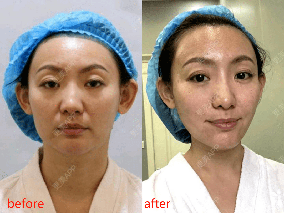 fa|谭松韵翻车了？