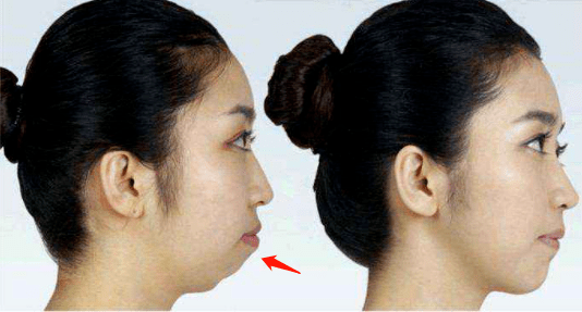 肤色|曾经全网为她哭瞎眼，如今带着一张惊艳众人的脸杀回来了