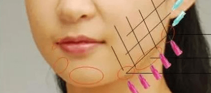 ffed2bbabcbc4a7dafd5683fd1c4656a.png