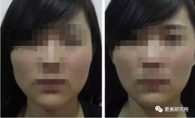 fa|今年最火的三字顶流这是要做鞠婧祎第二，换头动骨do全套？