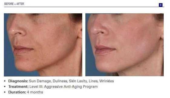 肌肤|十年如一日的真少女,我的抗老难题就这样被解决了