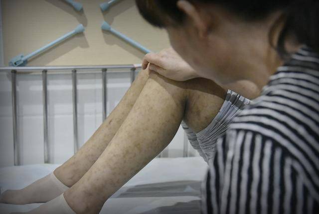妈妈|父亲却消失不见，“我不怪爸爸只想他回来”14岁男孩急等配型