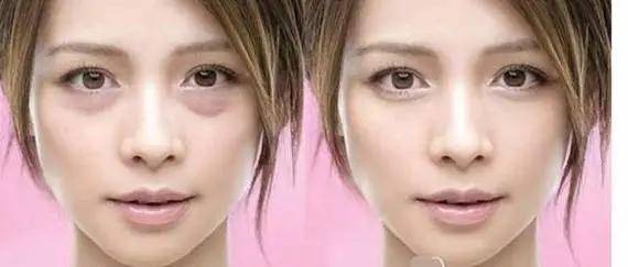 眼袋|从黑皮土妹变成CEO收割机，她到底do了什么？！