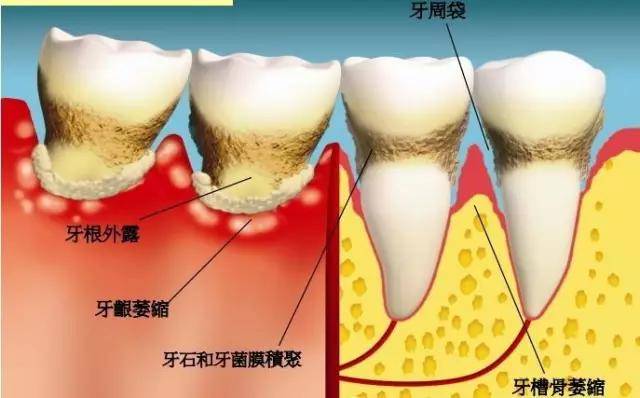 为什么会有免疫反应 0f01a2660b9b4ba6bf6383801459e200.jpeg