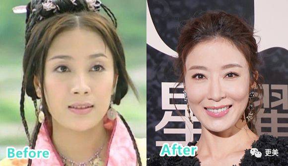 杨怡|曾经tvb一姐，演技一流，也把自己整僵了，假体太明显了...