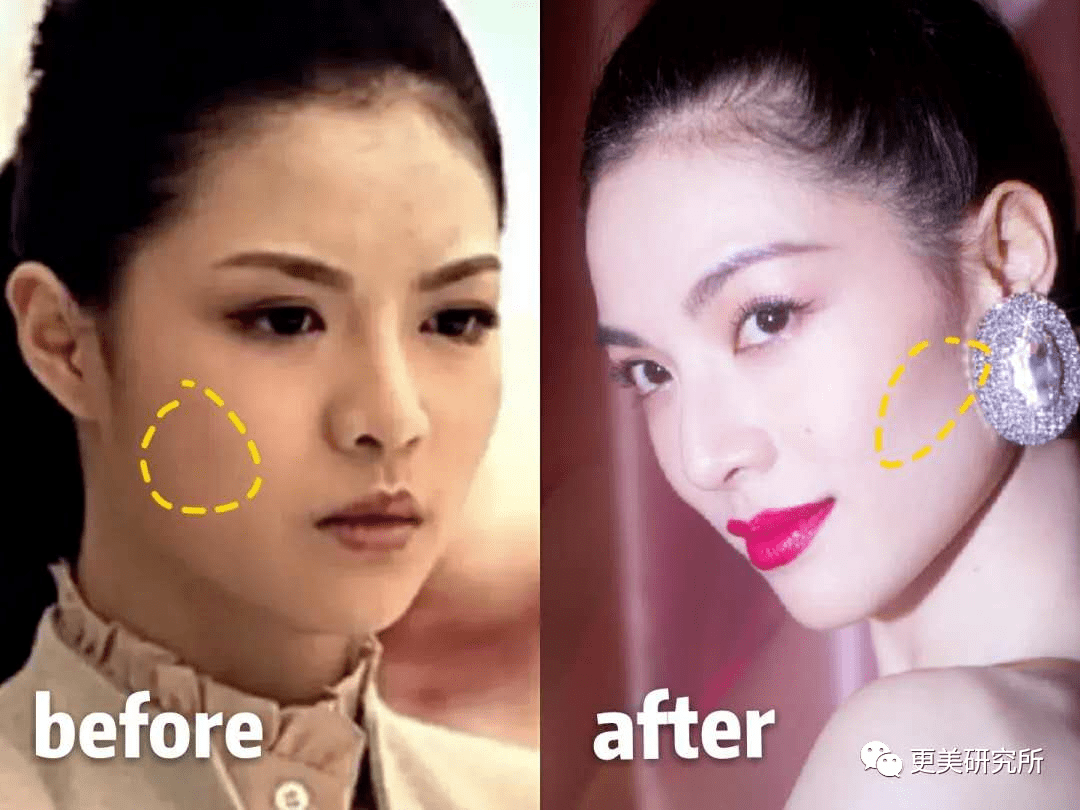 do|贵圈削骨图鉴 | 三代100个女星同时削掉半张脸、杨幂竟还垫底...