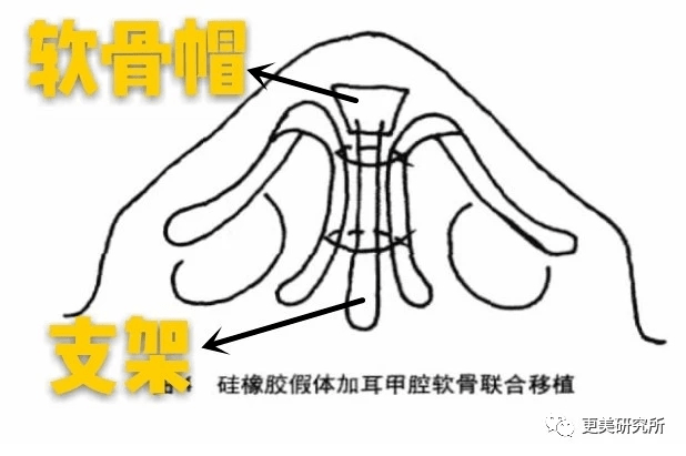 亚太|组团换头诈骗，居然成为亚太第一女团！10年修补，难回巅峰？