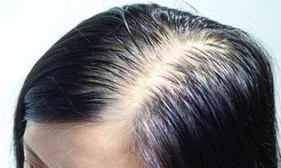 如何自己做头发护理 69fd99e8bf914d6cbe911947ac6ac03a.jpeg