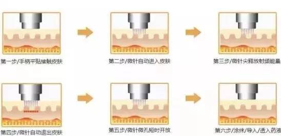 皮肤|16岁就上春晚的顶级流量，现在这脸怎么长残成这样了...