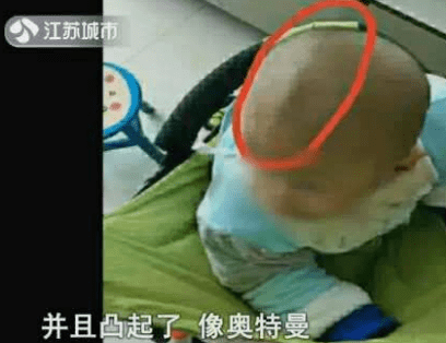 宝宝|你还没问宝宝乐不乐意呢巴巴的给宝宝睡成扁头