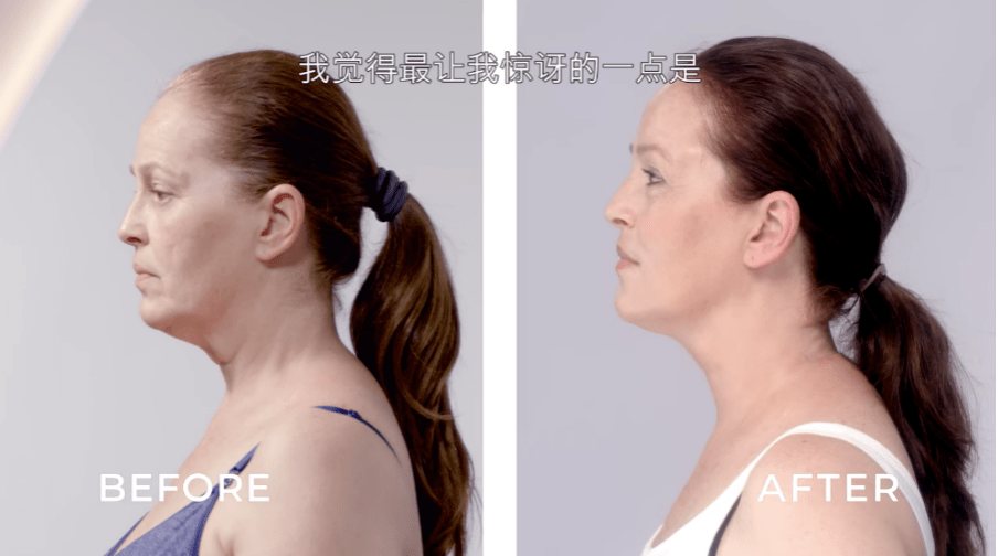 类节目|《皮肤救兵》,让变美成为一种自我表达