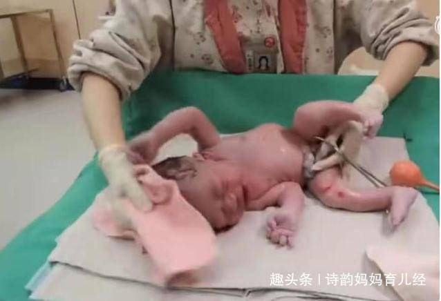 宝宝|被抱走的10分钟内都经历了啥？原来是去“洗剪吹”宝宝出生后