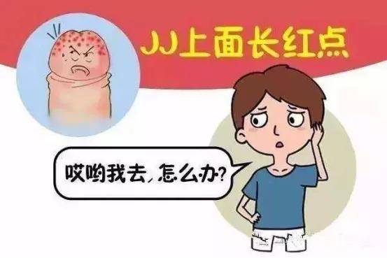 湿疣,疱疹,梅毒.各类性病的潜伏期有多久?