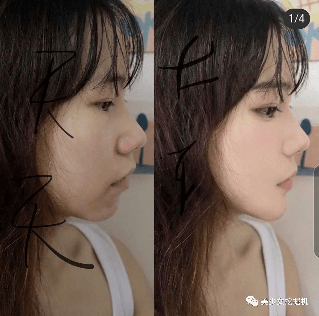 姐姐|整骨就能在辣妹和清纯茶艺妹之间无缝切换?亲妈都不认的假脸换头术太上头了···